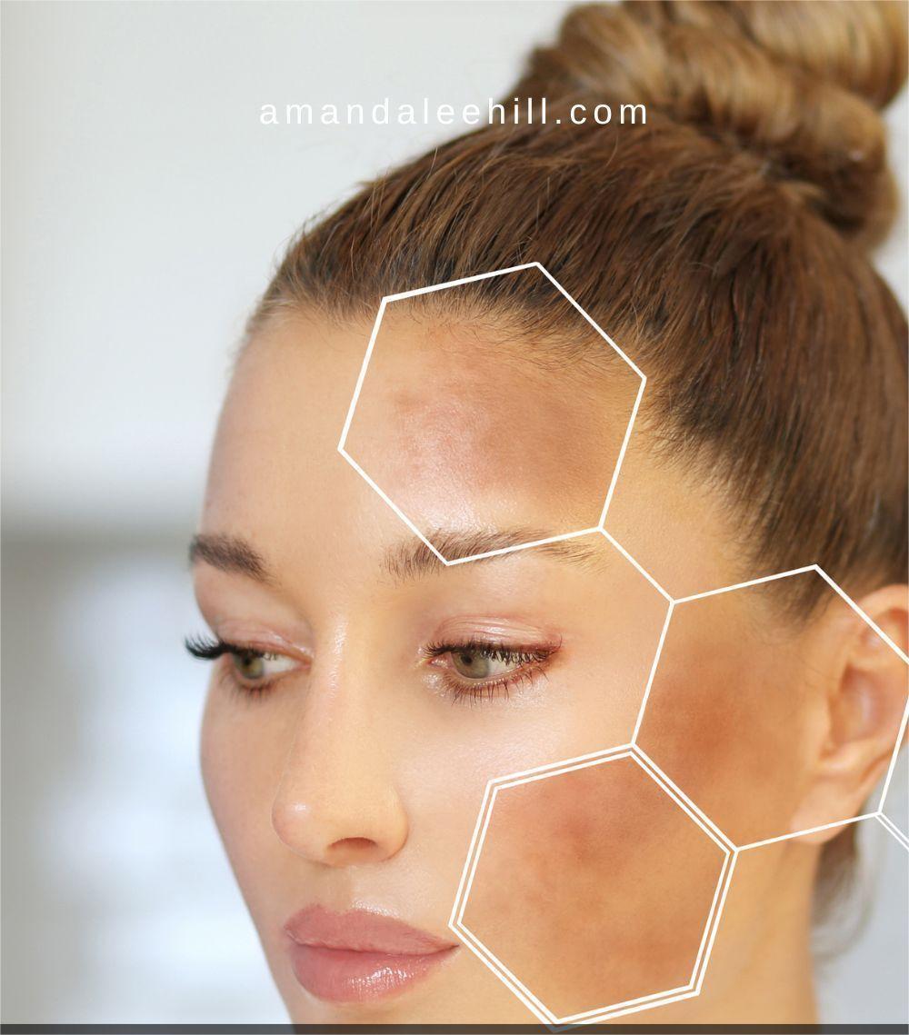 Skin Solutions